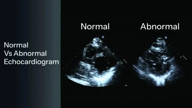 Understanding Echo Results: Normal Vs Abnormal Echocardiogram